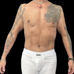 VASER Liposuction Before & After Patient #1015