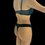 VASER Liposuction Before & After Patient #2614