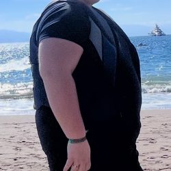 Weight Loss Program Before & After Patient #2997