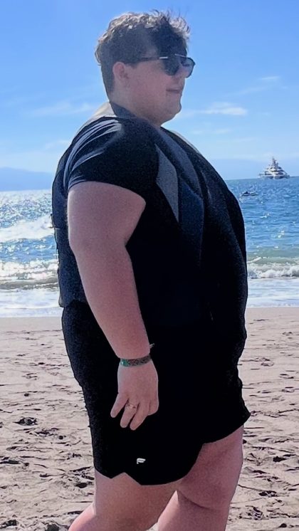 Weight Loss Program Before & After Patient #2997