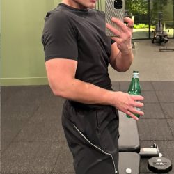 Weight Loss Program Before & After Patient #2997