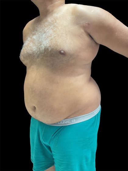Daddy Do Over Before & After Patient #2991